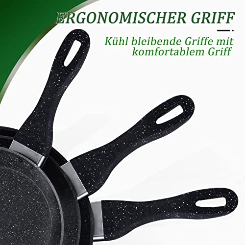 Scheffler Pfannenset, Pfanne 20/24/28 cm,Bratpfanne,Pfannen,beschichtete Pfanne,Pfanne Induktion mit Antihaft-Beschichtung,geeignet für alle Herdarten