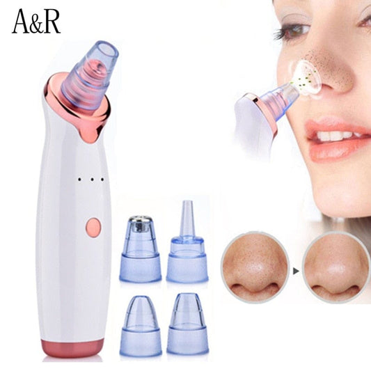 Facial Blackhead Remover Electric Acne Cleaner Blackhead Black Point Vacuum Cleaner Tool Black Spots Pore Cleaner Machine - wirbe-welt.shop
