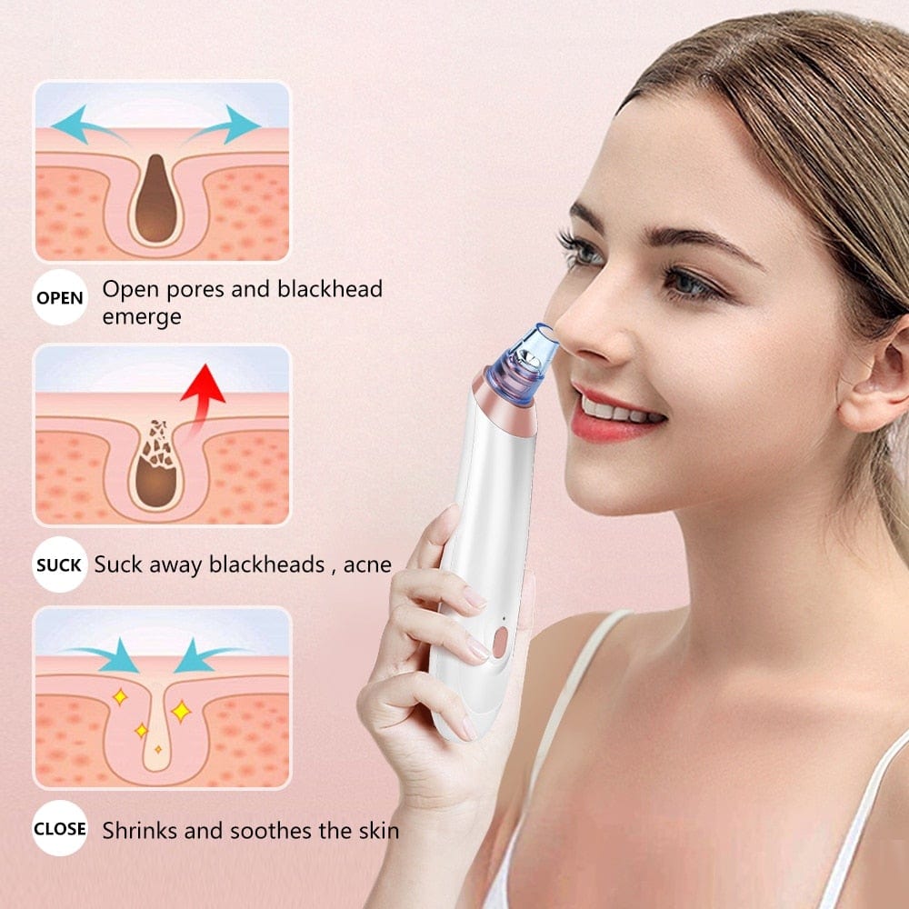 Face Nose Acne Black Dot Pimple Blackhead Remover Electric Blackhead Vacuum Cleaner Pore Blackhead Skin Care Tools Machine - wirbe-welt.shop