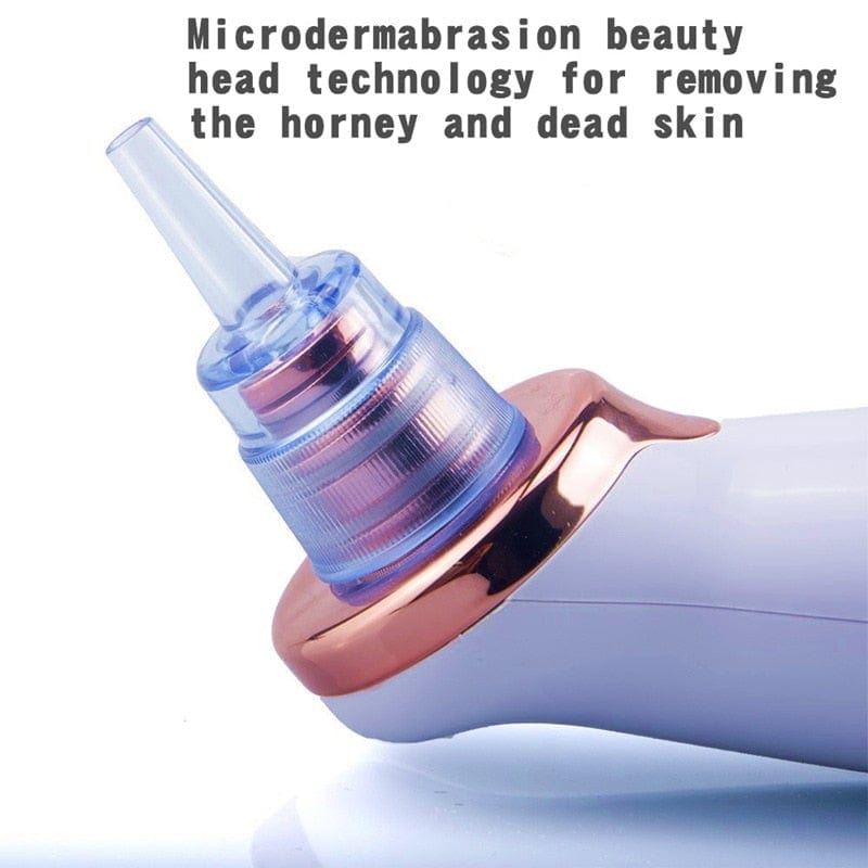 Facial Blackhead Remover Electric Acne Cleaner Blackhead Black Point Vacuum Cleaner Tool Black Spots Pore Cleaner Machine - wirbe-welt.shop