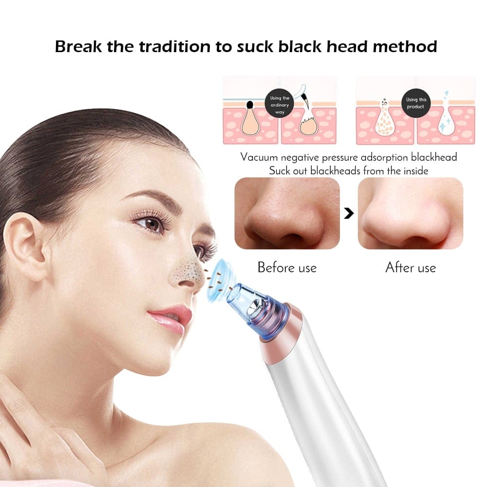Face Nose Acne Black Dot Pimple Blackhead Remover Electric Blackhead Vacuum Cleaner Pore Blackhead Skin Care Tools Machine - wirbe-welt.shop