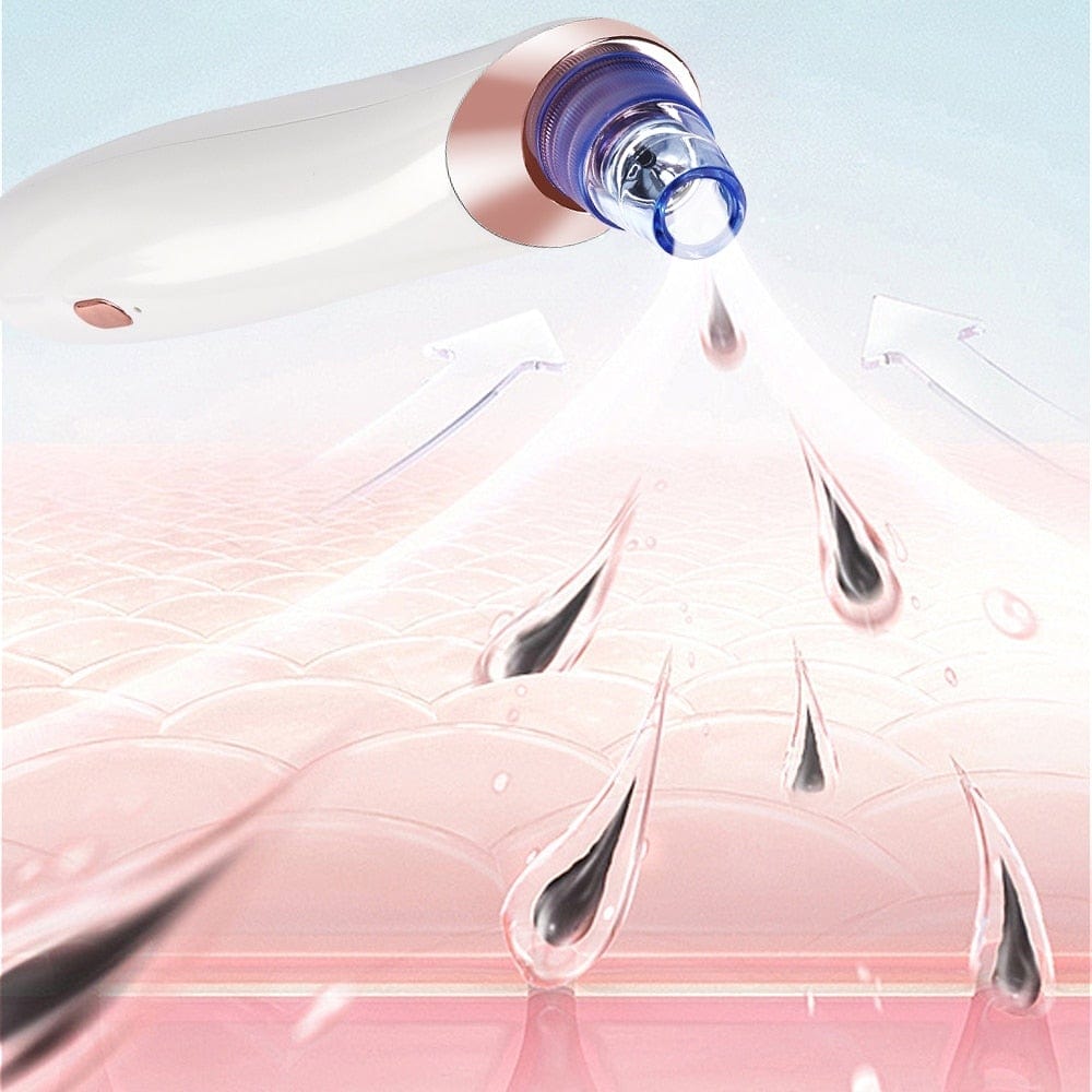 Face Nose Acne Black Dot Pimple Blackhead Remover Electric Blackhead Vacuum Cleaner Pore Blackhead Skin Care Tools Machine - wirbe-welt.shop