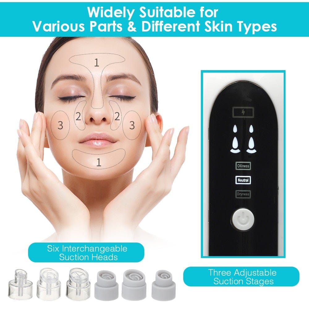 Blackhead Remover Pore Cleaner Vacuum Suction Acne Remover Pimple Black Dot Removal Facial Cleaning Beauty Tools Face Skin Care - wirbe-welt.shop