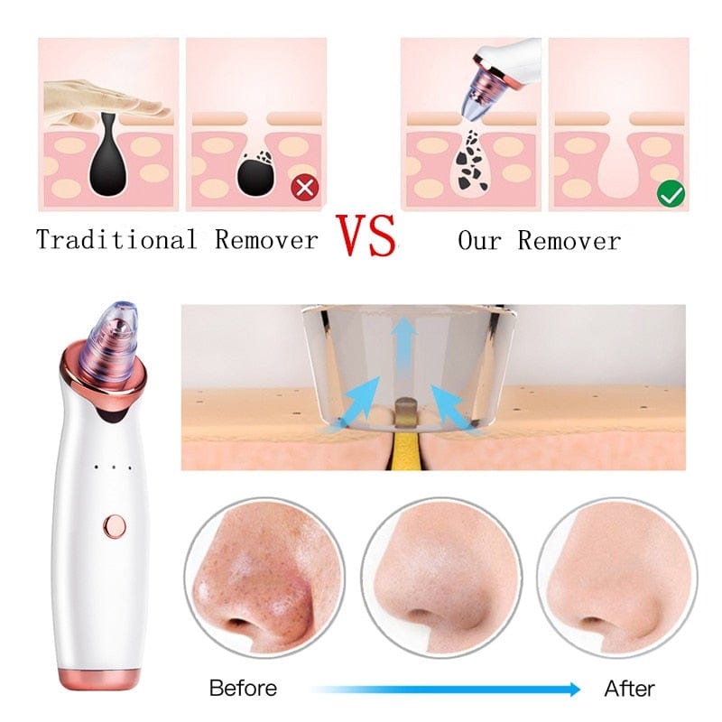 Facial Blackhead Remover Electric Acne Cleaner Blackhead Black Point Vacuum Cleaner Tool Black Spots Pore Cleaner Machine - wirbe-welt.shop