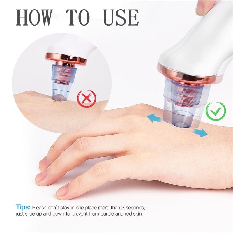 Facial Blackhead Remover Electric Acne Cleaner Blackhead Black Point Vacuum Cleaner Tool Black Spots Pore Cleaner Machine - wirbe-welt.shop